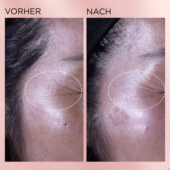 RETINOL + HPR Ceramide Capsules Rapid Skin Renewing Serum